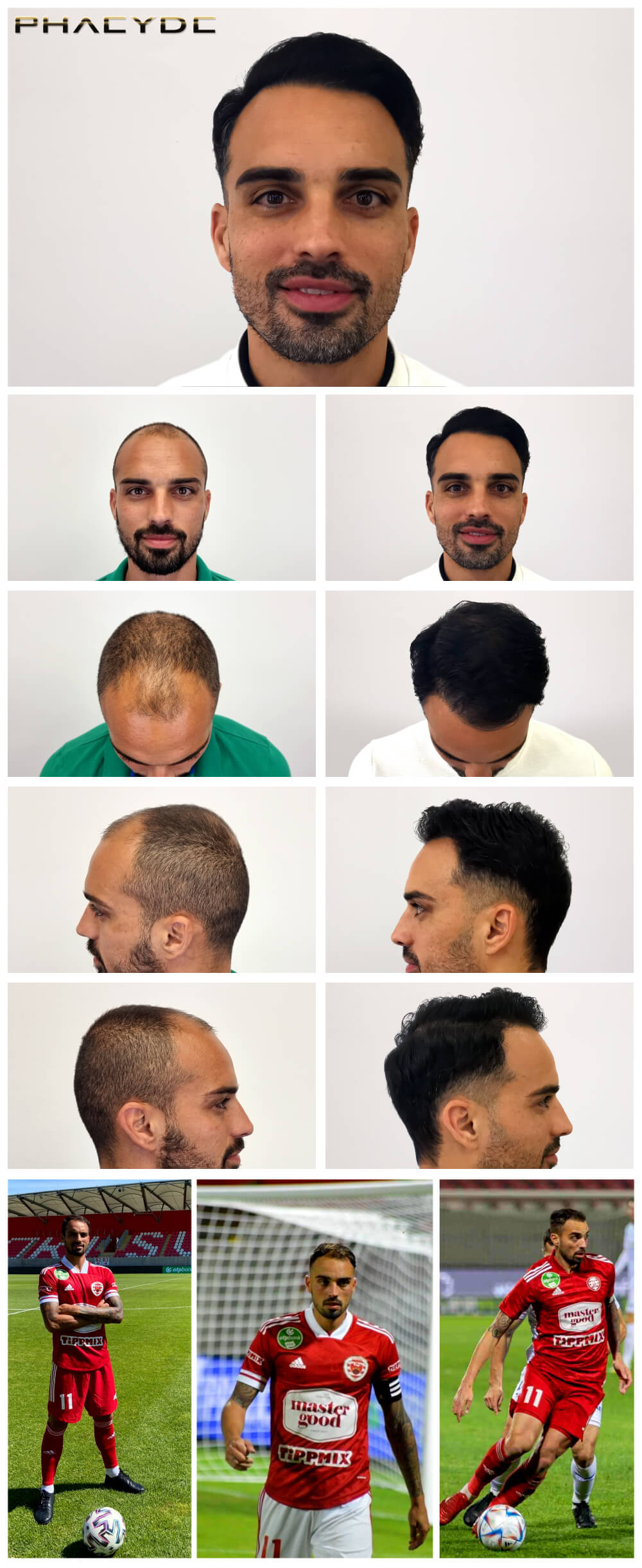 Lucas – 3600 щеплення